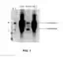 Fig. 04 - MATERIALS AND METHODS FOR DIAGNOSING AND TREATING SHELLFISH ALLERGY