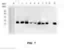 Fig. 08 - MATERIALS AND METHODS FOR DIAGNOSING AND TREATING SHELLFISH ALLERGY