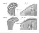 Fig. 02 - METHODS FOR DIAGNOSING OSTEOARTHRITIS