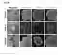 Fig. 10 - Polypeptides, nucleic acids and uses thereof