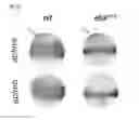 Fig. 45 - Polypeptides, nucleic acids and uses thereof