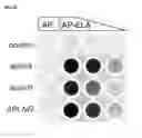 Fig. 49 - Polypeptides, nucleic acids and uses thereof