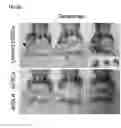 Fig. 64 - Polypeptides, nucleic acids and uses thereof