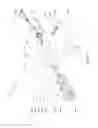 Fig. 40 - Method and device for slide scanning