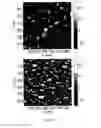 Fig. 07 - CONTACT LENS WITH SPATIALLY HETEROGENOUS SURFACE PATTERNS FOR IMPROVED LUBRICITY