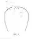 Fig. 04 - LOW-POWER EYEWEAR FOR REDUCING SYMPTOMS OF COMPUTER VISION SYNDROME