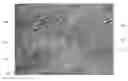 Fig. 01 - Adaptive artifact removal