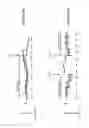 Fig. 08 - Adaptive artifact removal