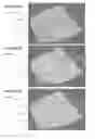 Fig. 09 - Adaptive artifact removal