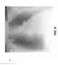 Fig. 10 - Tomosynthesis reconstruction with rib suppression