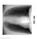 Fig. 13 - Tomosynthesis reconstruction with rib suppression