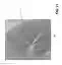 Fig. 15 - Tomosynthesis reconstruction with rib suppression