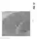 Fig. 16 - Tomosynthesis reconstruction with rib suppression