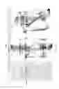 Fig. 16 - Orthopedic treatment device co-display systems and methods