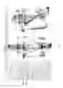 Fig. 17 - Orthopedic treatment device co-display systems and methods