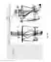 Fig. 98 - Orthopedic treatment device co-display systems and methods