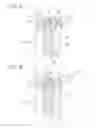 Fig. 08 - Solid-state imaging element, manufacturing method, and electronic device