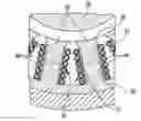 Fig. 01 - Stator for an electric motor