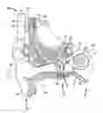 Fig. 01 - MEDICAL DEVICE HAVING AN IMPULSE FORCE-RESISTANT COMPONENT