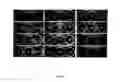 Fig. 20 - Selection of symbiota by screening multiple host-symbiont associations