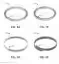 Fig. 02 - Neck Seal Tension Relief Ring Apparatus and Method of Using Same