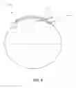 Fig. 04 - Neck Seal Tension Relief Ring Apparatus and Method of Using Same
