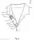 Fig. 06 - SHIRT WITH INTERIOR POCKET AT NECK PLACKET