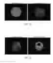 Fig. 09 - Objective quality metric for ocular wavefront measurements