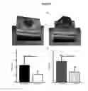 Fig. 09 - Method and System for Optic Nerve Head Shape Quantification