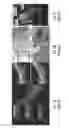 Fig. 02 - Optical systems for whole eye imaging and biometry