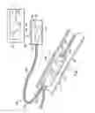 Fig. 02 - DEVICE, SYSTEM, AND METHOD FOR ASSESSING INTRAVASCULAR PRESSURE