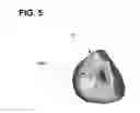 Fig. 07 - Noninvasive cardiac therapy evaluation