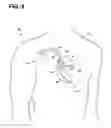 Fig. 11 - Noninvasive cardiac therapy evaluation