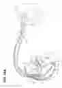 Fig. 12 - Noninvasive cardiac therapy evaluation