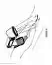 Fig. 08 - Module Mounting Mirror Endoscopy