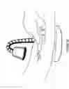 Fig. 09 - Module Mounting Mirror Endoscopy