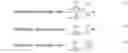 Fig. 02 - Analysis and characterization of patient signals