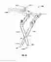 Fig. 49 - Minimally open interbody access retraction device and surgical method