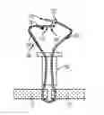 Fig. 01 - Knotless collapsible sutures and methods for suturing