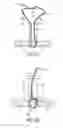 Fig. 04 - Knotless collapsible sutures and methods for suturing