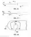 Fig. 23 - Methods and systems for medializing a turbinate