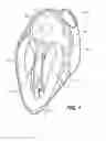 Fig. 02 - Devices and systems for closing the left atrial appendage