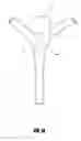 Fig. 13 - VASCULAR REMODELING DEVICE