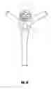 Fig. 15 - VASCULAR REMODELING DEVICE
