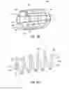 Fig. 07 - Bodily lumen occlusion