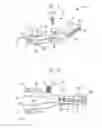 Fig. 02 - Cutting guide with internal distraction