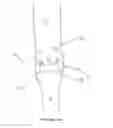 Fig. 49 - Arthroplasty systems and methods for optimally aligning and tensioning a knee prosthesis
