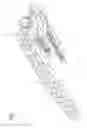 Fig. 02 - Aiming device for targeted drilling of bone