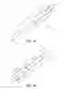 Fig. 02 - ANKLE REPLACEMENT SYSTEM AND METHOD