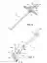 Fig. 09 - ANKLE REPLACEMENT SYSTEM AND METHOD